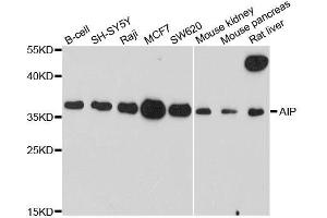 Western blot analysis of extracts of various cell lines, using AIP antibody. (AIP 抗体  (AA 1-330))