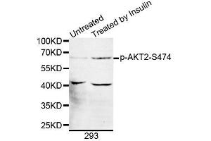 Western blot analysis of extracts of 293 cells, using Phospho-AKT2-S474 antibody (ABIN5969868). (AKT2 抗体  (pSer474))