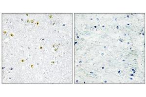 Immunohistochemistry analysis of paraffin-embedded human brain tissue using TRIM24 antibody. (TRIM24 抗体  (C-Term))