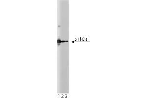 Western Blotting (WB) image for anti-PKA RIIalpha (AA 1-404) antibody (ABIN968784) (PKA RIIalpha (AA 1-404) 抗体)