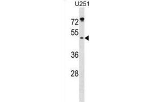 Western Blotting (WB) image for anti-Integrin-Linked Kinase-Associated Serine/threonine Phosphatase 2C (ILKAP) antibody (ABIN3000918) (ILKAP 抗体)