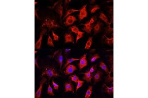 Immunofluorescence analysis of NIH/3T3 cells using ENO2 antibody. (ENO2/NSE 抗体  (AA 195-434))