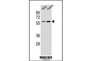 Western blot analysis in WiDr,HepG2 cell line lysates (35ug/lane). (HOXA10 抗体  (AA 244-271))