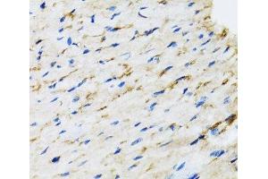 Immunohistochemistry of paraffin-embedded Rat heart using RAF1 Polyclonal Antibody at dilution of 1:100 (40x lens). (RAF1 抗体)