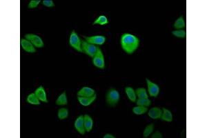 Immunofluorescence staining of Hela cells with ABIN7151572 at 1:200, counter-stained with DAPI. (IKAP/p150 抗体  (AA 1107-1258))