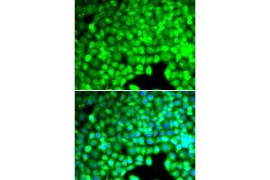 Immunofluorescence analysis of U2OS cells using CYTH2 antibody (ABIN5974231). (Cytohesin 2 抗体)