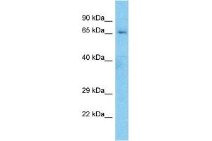 Host:  Rabbit  Target Name:  ES8L1  Sample Type:  MDA-MB-435s Whole Cell lysates  Antibody Dilution:  1. (EPS8-Like 1 抗体  (C-Term))