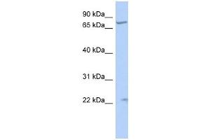 STRA6 antibody used at 1 ug/ml to detect target protein. (STRA6 抗体)