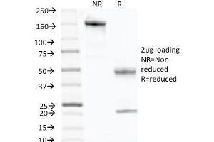 SDS-PAGE Analysis of Purified, BSA-Free p57 Antibody (clone KP10). (P57 抗体)