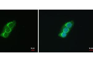 ICC/IF Image SEC13L1 antibody [N1C3] detects SEC13L1 protein at COP II vesicles by immunofluorescent analysis. (SEC13 抗体  (Center))
