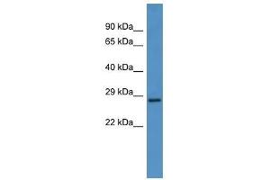 Western Blot showing CEACAM7 antibody used at a concentration of 1-2 ug/ml to detect its target protein. (CEACAM7 抗体  (N-Term))