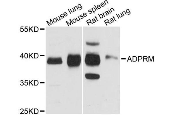ADPRM 抗体