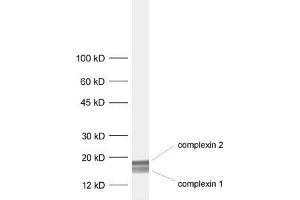 dilution: 1 : 1000, sample: rat brain homogenate (Complexin 1, 2 (C-Term) 抗体)