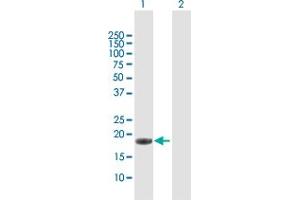 Western Blot analysis of IL17C expression in transfected 293T cell line by IL17C MaxPab polyclonal antibody. (IL17C 抗体  (AA 1-197))