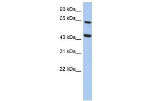 EFHA2 antibody used at 1 ug/ml to detect target protein. (EFHA2 抗体  (N-Term))