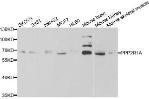 Western blot analysis of extracts of various cell lines, using PPP2R1A antibody. (PPP2R1A 抗体)