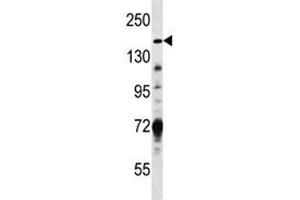 Hamartin antibody western blot analysis in MDA-MB231 lysate (TSC1 抗体  (AA 401-430))