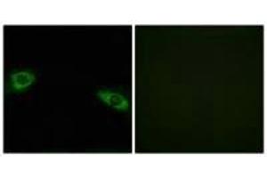 Immunofluorescence analysis of HuvEc cells, using RPS4Y1 antibody. (RPS4Y1 抗体  (C-Term))