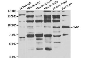 Western blot analysis of extracts of various cell lines, using IWS1 antibody. (IWS1 抗体)