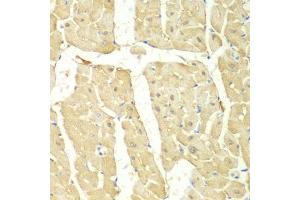 Immunohistochemistry of paraffin-embedded mouse heart using PSMC2 antibody (ABIN5971033) at dilution of 1/100 (40x lens). (PSMC2 抗体)