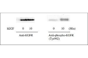 Western Blotting (WB) image for Epidermal Growth Factor Receptor (EGFR) ELISA Kit (ABIN1981829)