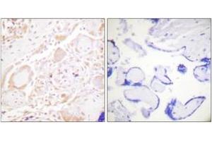 Immunohistochemistry (IHC) image for anti-GATA Binding Protein 3 (GATA3) (AA 274-323) antibody (ABIN2888838) (GATA3 抗体  (AA 274-323))