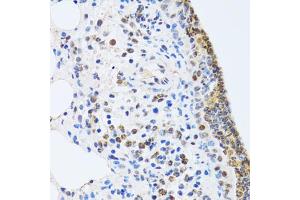 Immunohistochemistry of paraffin-embedded rat lung using MTA3 antibody (ABIN5974011) at dilution of 1/100 (40x lens). (MTA3 抗体)