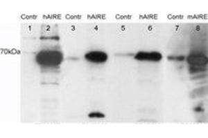 Image no. 1 for anti-Autoimmune Regulator (AIRE) (C-Term) antibody (ABIN374235) (AIRE 抗体  (C-Term))