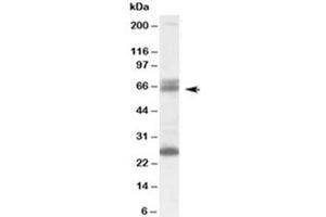Western blot testing of human brain lysate with GAD65 antibody at 0. (GAD65 抗体)