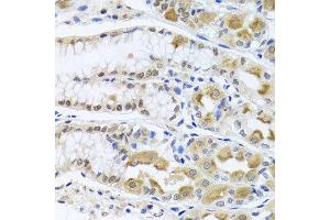 Immunohistochemistry of paraffin-embedded human gastric using TRMT1 antibody at dilution of 1:100 (x40 lens). (TRMT1 抗体)