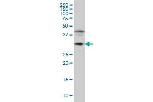 POU6F1 monoclonal antibody (M01), clone 6H1 Western Blot analysis of POU6F1 expression in Jurkat . (POU6F1 抗体  (AA 193-301))