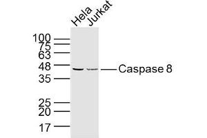 Lane 1: hela lysates Lane 2: jurkat lysates probed with Caspase 8 Monoclonal Polyclonal Antibody, Unconjugated  at 1:300 dilution and 4˚C overnight incubation. (Caspase 8 抗体)