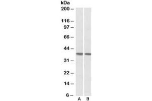 Western blot testing of human heart [A] and lung [B] lysates with KLF2 antibody at 1ug/ml. (KLF2 抗体)