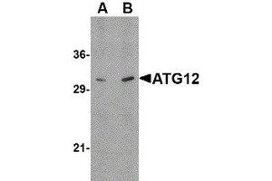 Western Blotting (WB) image for anti-Autophagy Related 12 (ATG12) (N-Term) antibody (ABIN2477525) (ATG12 抗体  (N-Term))