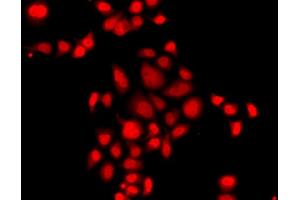 Immunofluorescence analysis of A549 cells using MLF1 antibody (ABIN5974950). (MLF1 抗体)
