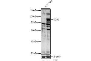 Western blot analysis of extracts of ECV-304 cells, using EGR1 antibody (ABIN6133683, ABIN6139992, ABIN7101807 and ABIN7101808) at 1:1000 dilution. (EGR1 抗体  (AA 1-250))