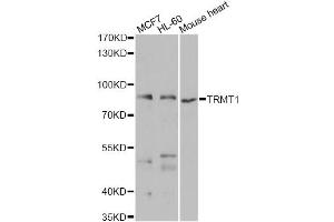 Western blot analysis of extracts of various cell lines, using TRMT1 antibody (ABIN2560567) at 1:1000 dilution. (TRMT1 抗体)