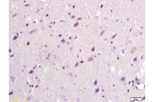 Formalin-fixed and paraffin embedded: rat brain tissue labeled with Anti-NR2B/NMDAR2B Polyclonal Antibody, Unconjugated  at 1:300, followed by conjugation to the secondary antibody and DAB staining (GRIN2B 抗体  (AA 451-550))