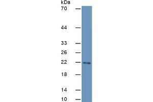 Western Blotting (WB) image for Insulin-Like Growth Factor 1 (IGF1) ELISA Kit (ABIN6730874)