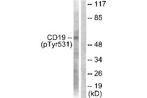 Western blot analysis of extracts from COS7 cells, treated with Serum (10%, 30mins), using CD19 (Phospho-Tyr531) Antibody. (CD19 抗体  (pTyr531))