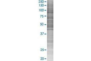 UGT1A6 transfected lysate. (UGT1A6 293T Cell Transient Overexpression Lysate(Denatured))