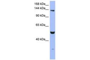 Image no. 1 for anti-MutS Homolog 6 (E. Coli) (MSH6) (AA 251-300) antibody (ABIN6743061) (MSH6 抗体  (AA 251-300))