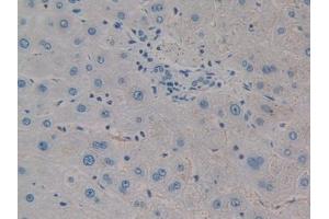 DAB staining on IHC-P; Samples: Human Liver Tissue (CTHRC1 抗体  (AA 31-243))