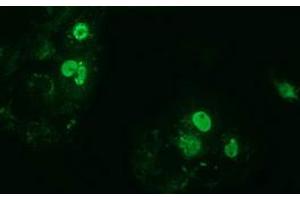 Anti-ZIM2 mouse monoclonal antibody (ABIN2453801) immunofluorescent staining of COS7 cells transiently transfected by pCMV6-ENTRY ZIM2 (RC211188). (ZIM2 抗体  (AA 1-150, AA 428-527))