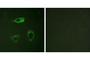 P-peptide - +Western blot analysis of extracts from COS cells, treated with EGF (200ng/ml, 30mins), using CD18/ITGB2 (Phospho-Thr758) antibody. (Integrin beta 2 抗体  (pThr758))