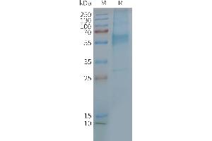 Human GIPR-Nanodisc, Flag Tag on SDS-PAGE (GIPR 蛋白)