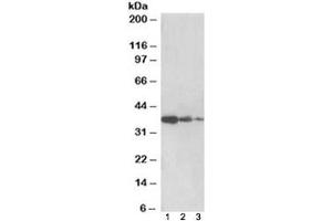 Western blot testing of human liver lysate [lane 1], mouse liver [lane 2] and rat liver [lane 3] with PP2A antibody at 0. (PPP2R4 抗体)