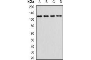 Western blot analysis of Alpha E-catenin expression in HEK293T (A), MCF7 (B), mouse kidney (C), mouse brain (D) whole cell lysates. (CTNNA1 抗体)