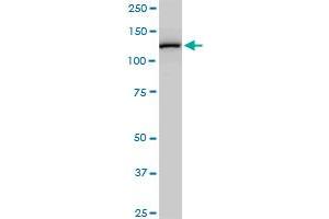 CAND1 monoclonal antibody (M03), clone 2D7. (CAND1 抗体  (AA 1-100))