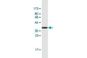 Western Blot detection against Immunogen (36. (FBXO11 抗体  (AA 744-843))